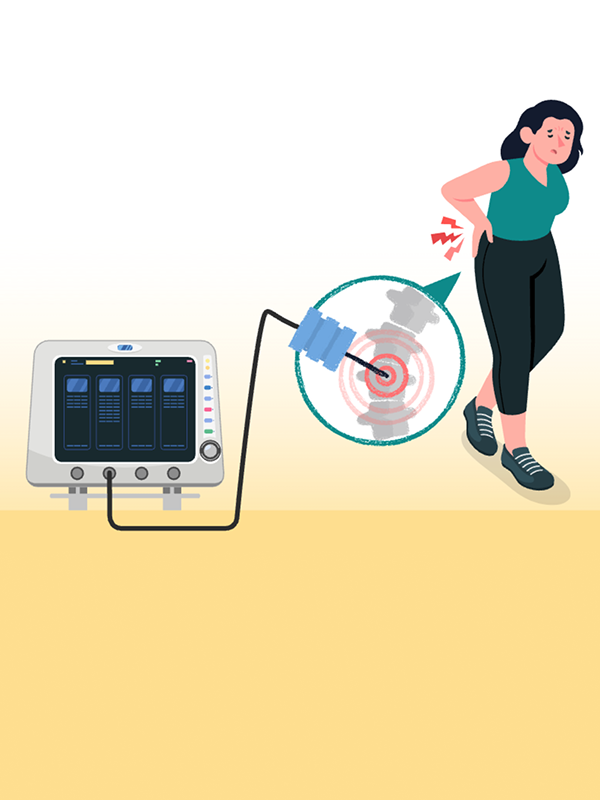 รายงานฉบับสมบูรณ์: การประเมินความคุ้มค่าของ Medial branch Radiofrequency ablation สำหรับโรคปวดหลังส่วนล่างเรื้อรังจาก facet joints