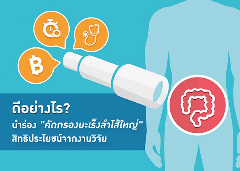 จากต้นแบบสู่ทั่วประเทศ “ตรวจคัดกรองมะเร็งลำไส้ใหญ่” ที่งานวิจัยสนับสนุนให้เพิ่มสิทธิ