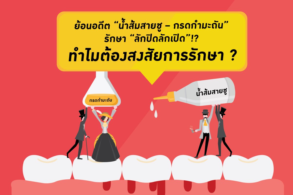 ย้อนอดีต “น้ำส้มสายชู – กรดกำมะถัน” รักษา “ลักปิดลักเปิด”!? เหตุใดจึงต้องสงสัยการรักษา