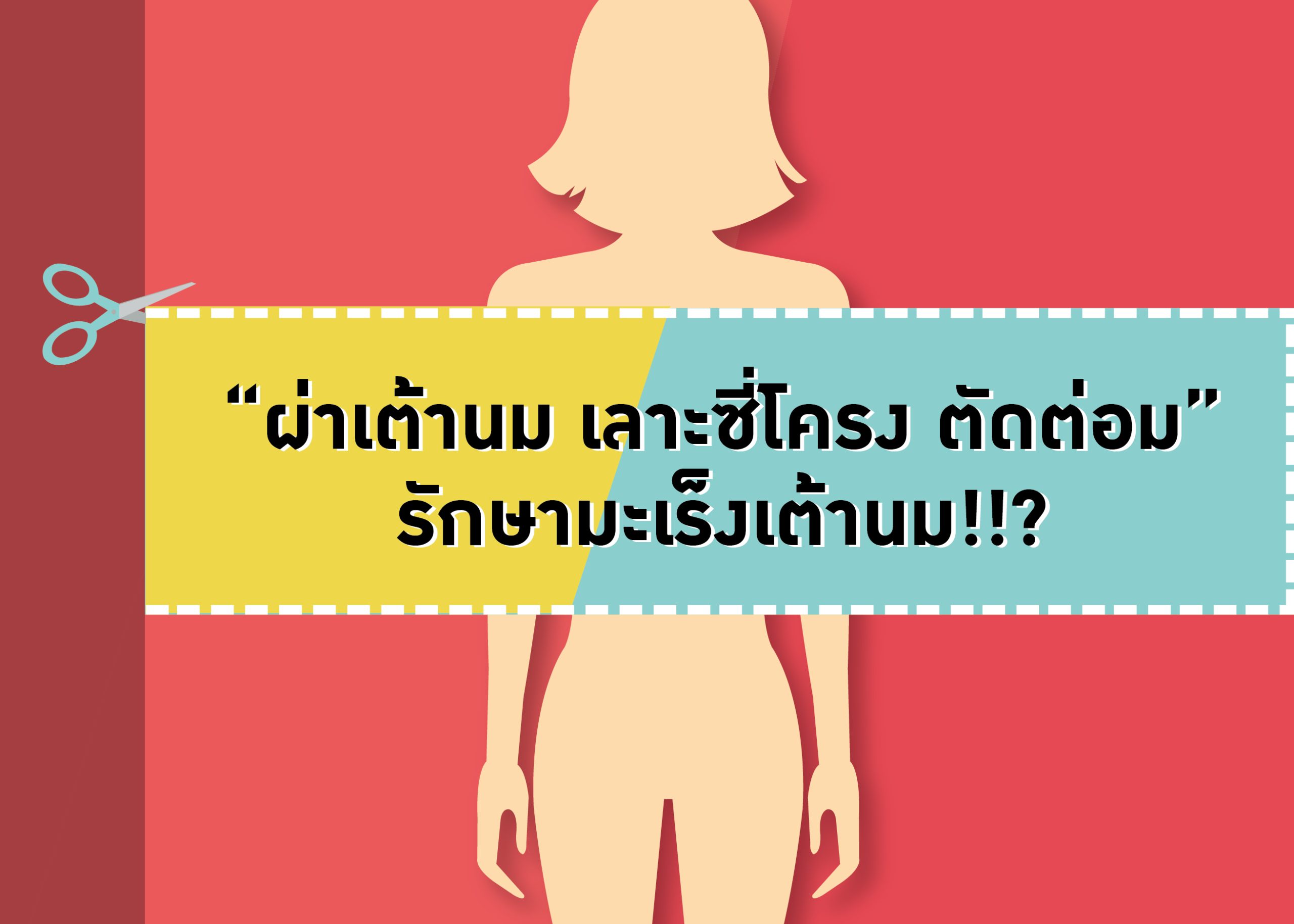 ย้อนบทเรียน “ผ่าเต้านม เลาะซี่โครง ตัดต่อมน้ำเหลือง” เพื่อรักษามะเร็งเต้านม