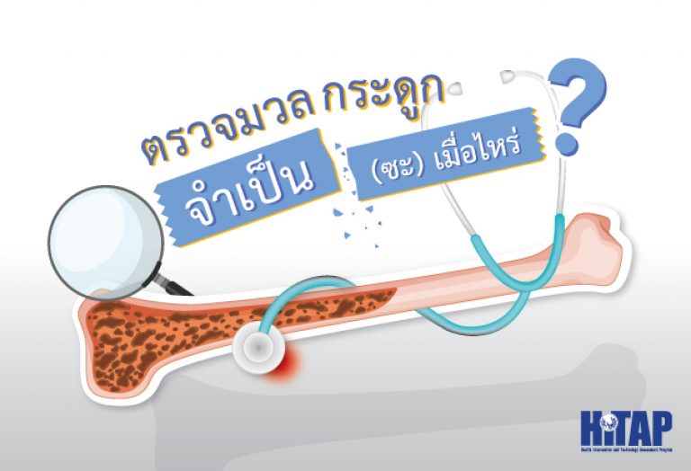ตรวจมวลกระดูก จำเป็น(ซะ)เมื่อไหร่ ?