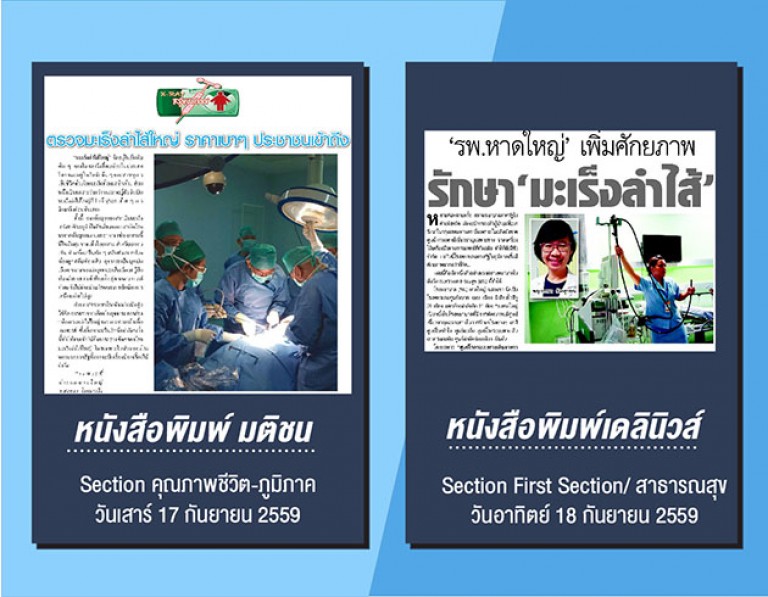 มะเร็งลำไส้ใหญ่