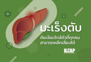 “มะเร็งตับ” ภัยเงียบใกล้ตัวที่ทุกคนสามารถหลีกเลี่ยงได้