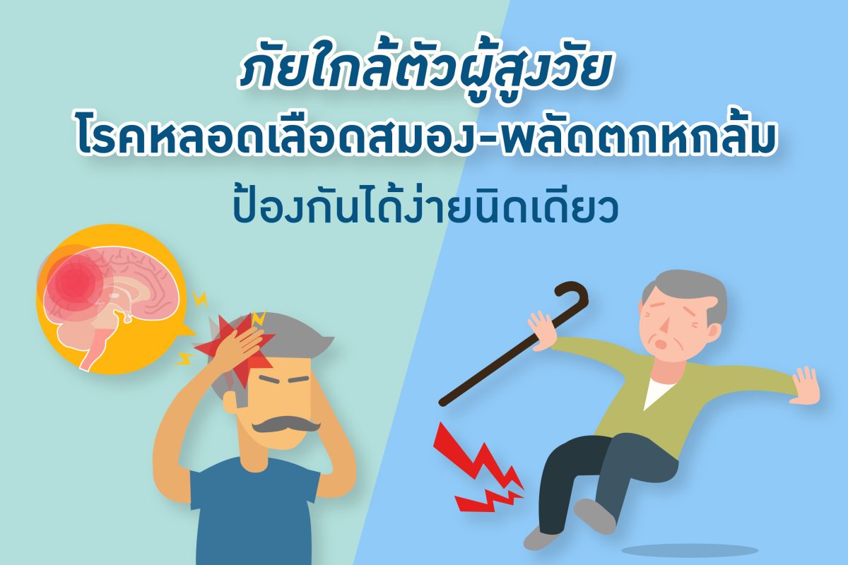 ภัยใกล้ตัวผู้สูงวัย “โรคหลอดเลือดสมอง – พลัดตกหกล้ม” ป้องกันได้ง่ายนิดเดียว