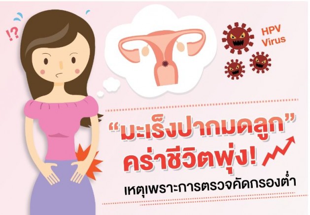 หยิบข่าวมาเล่า: “มะเร็งปากมดลูก” คร่าชีวิตพุ่งเหตุตรวจคัดกรองต่ำ HITAP เผยงานวิจัยชี้คัดกรองด้วย VIA ร่วมกับ pap smear ที่อายุ 30 ปีขึ้นไปมีความคุ้มค่ามากที่สุด