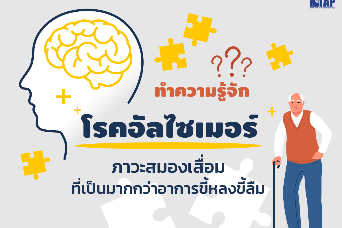 ทำความรู้จัก “โรคอัลไซเมอร์” ภาวะสมองเสื่อมที่เป็นมากกว่าอาการขี้หลงขี้ลืม
