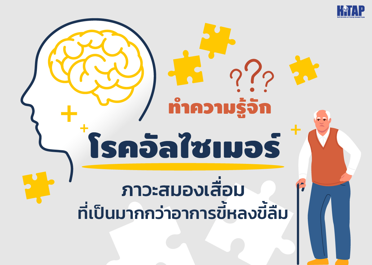 ทำความรู้จัก “โรคอัลไซเมอร์” ภาวะสมองเสื่อมที่เป็นมากกว่าอาการขี้หลงขี้ลืม
