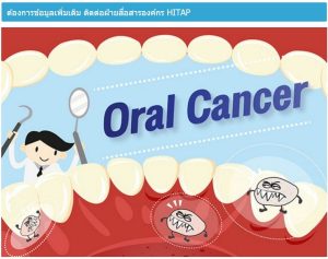รู้เร็ว มะเร็งร้ายในปากคุณ