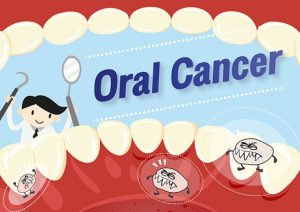 รู้เร็ว มะเร็งร้ายในปากคุณ