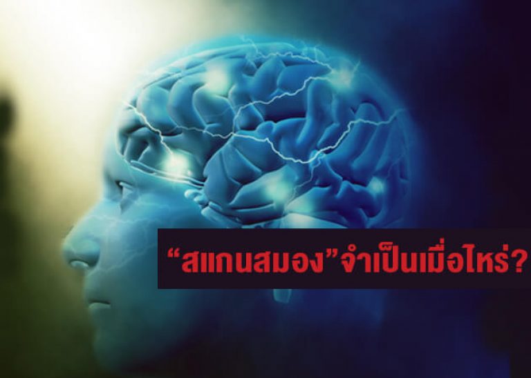 สแกนสมองเมื่อเจ็บศีรษะ จำเป็น(ซะ)เมื่อไหร่?