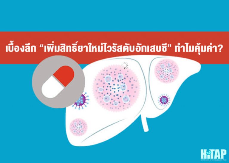 เบื้องลึก “เพิ่มสิทธิ์ยาใหม่ไวรัสตับอักเสบซี” คุ้มค่าอย่างไร?