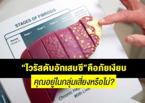 “ไวรัสตับอักเสบซี” คือภัยเงียบ…คุณอยู่ในกลุ่มเสี่ยงหรือไม่?