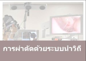 การผ่าตัดด้วยระบบนำวิถี ยังไม่เป็นสิทธิประโยชน์ในระบบหลักประกันสุขภาพถ้วนหน้า