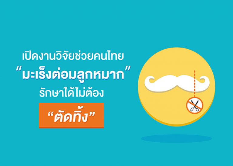เปิดงานวิจัยช่วยคนไทยใช้ยารักษา “มะเร็งต่อมลูกหมาก” ไม่ต้อง “ตัดทิ้ง” ฟรี