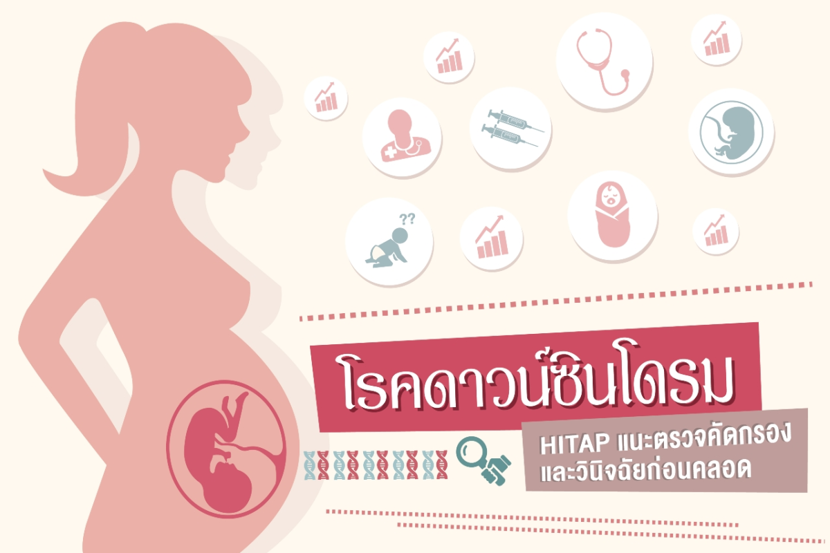 หยิบข่าวมาเล่า: หยุดความเสี่ยง!! “โรคดาวน์ซินโดรม” HITAP แนะตรวจคัดกรองและวินิจฉัยก่อนคลอด