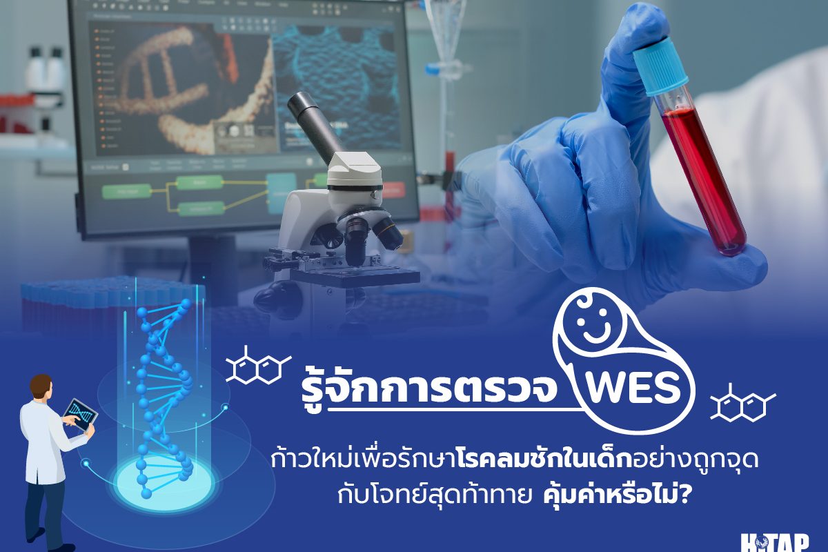 รู้จักการตรวจ “WES” ก้าวใหม่เพื่อรักษาโรคลมชักในเด็กอย่างถูกจุดกับโจทย์สุดท้าทาย คุ้มค่าหรือไม่?