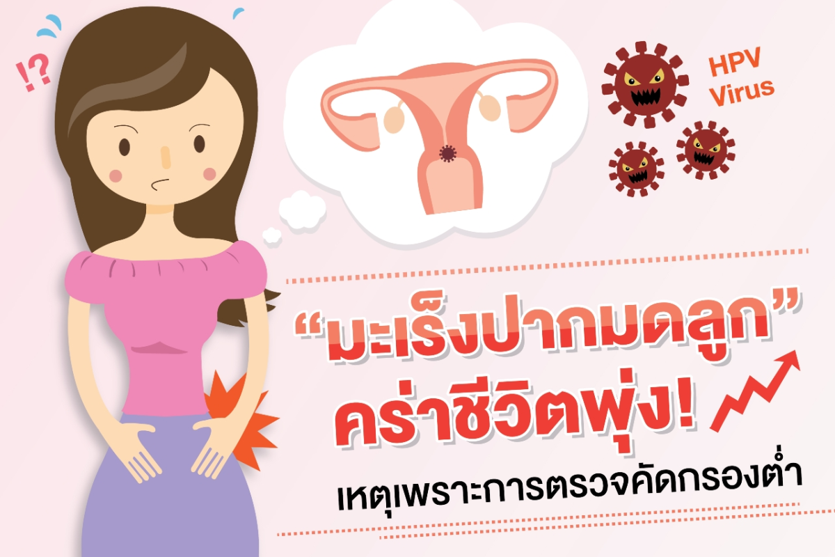หยิบข่าวมาเล่า: “มะเร็งปากมดลูก” คร่าชีวิตพุ่งเหตุตรวจคัดกรองต่ำ HITAP เผยงานวิจัยชี้คัดกรองด้วย VIA ร่วมกับ pap smear ที่อายุ 30 ปีขึ้นไปมีความคุ้มค่ามากที่สุด