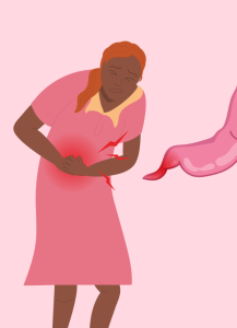 Data ช่วงการระบาดโควิด-19 พบการผ่าตัดไส้ติ่งอักเสบอาจเกินจำเป็น