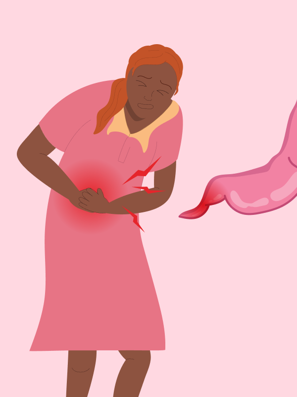 Data ช่วงการระบาดโควิด-19 พบการผ่าตัดไส้ติ่งอักเสบอาจเกินจำเป็น