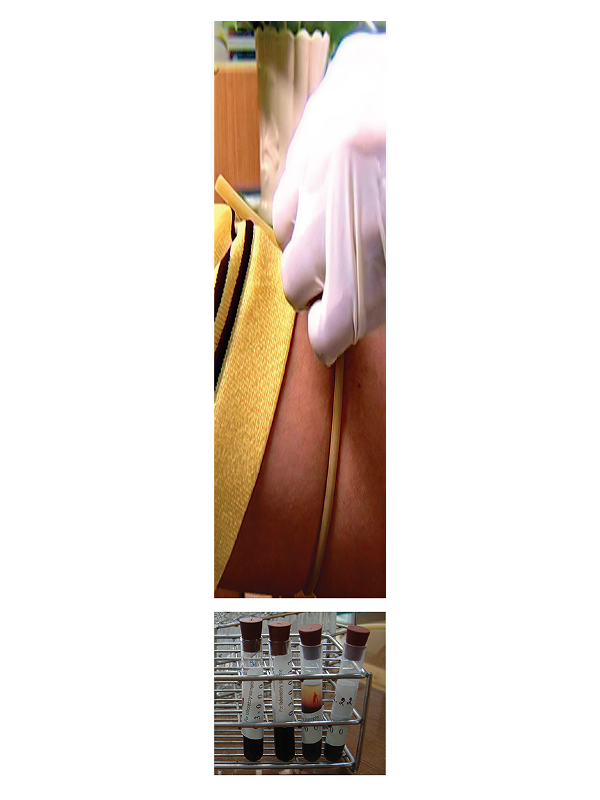 The potential of provider-initiated voluntary HIV counseling and testing at healthcare settings in Thailand