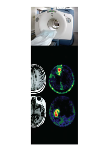 การศึกษาความเป็นไปได้และความเหมาะสมของการใช้เทคโนโลยีเพทซีทีในประเทศไทย