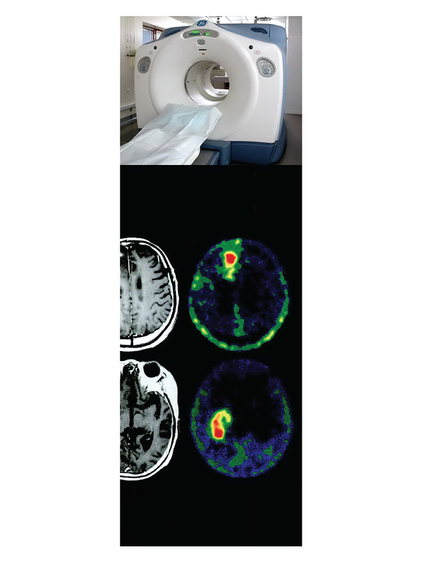 การศึกษาความเป็นไปได้และความเหมาะสมของการใช้เทคโนโลยีเพทซีทีในประเทศไทย