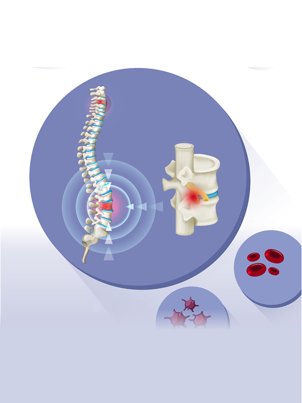 รายงานฉบับสมบูรณ์: การประเมินความคุ้มค่าของการปลูกถ่ายเซลล์ต้นกำเนิดในผู้ป่วยมะเร็งไขกระดูก