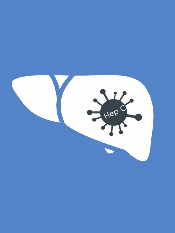 การคัดกรองไวรัสตับอักเสบซีและรักษาโรคไวรัสตับอักเสบซีในผู้ติดเชื้อเอชไอวีด้วยยา peginterferon ร่วมกับ ribavirin มีความคุ้มค่าสำหรับประเทศไทย