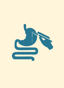 ความคุ้มค่าของการรักษาเสริมด้วยยา imatinib ในผู้ป่วยโรคมะเร็ง GIST หลังการผ่าตัด