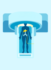 Gadoxetic acid สารเพิ่มความแม่นยำวินิจฉัยมะเร็งตับชนิดเอชซีซี ดีและคุ้มค่า