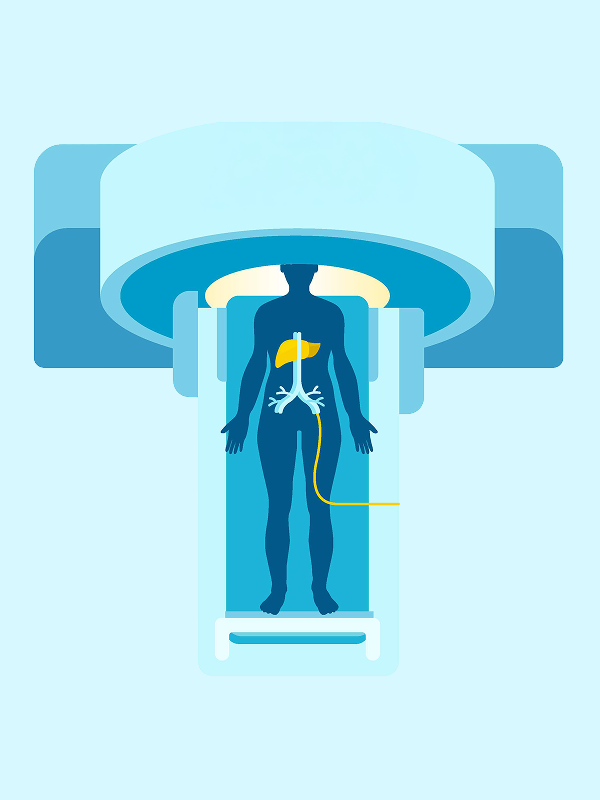 Gadoxetic acid สารเพิ่มความแม่นยำวินิจฉัยมะเร็งตับชนิดเอชซีซี ดีและคุ้มค่า