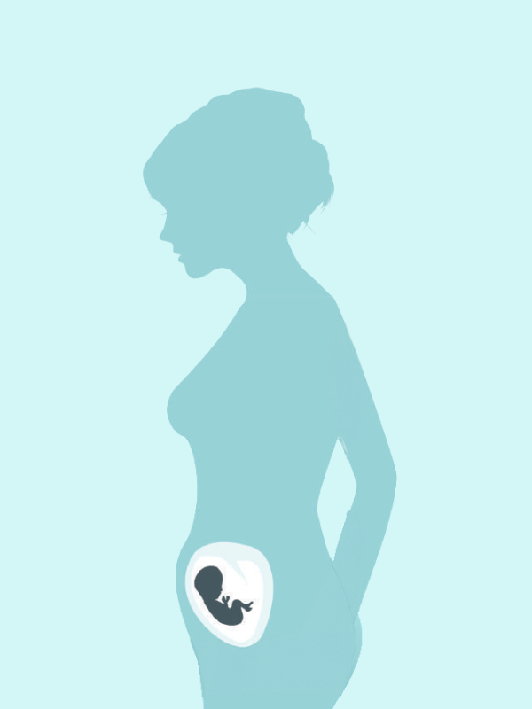 จัดบริการตรวจกรองกลุ่มอาการดาวน์อย่างไรให้ได้ผล ก่อนผลักดันเป็นนโยบายระดับประเทศ