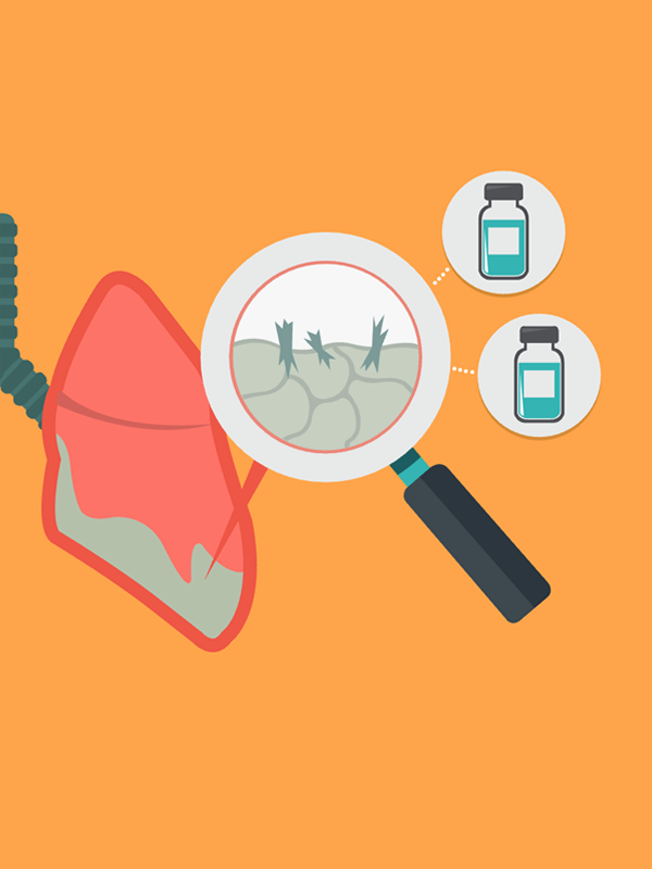 รายงานวิจัย: การประเมินต้นทุนอรรถประโยชน์ของยา pemetrexed ร่วมกับ platinum สำหรับการรักษามะเร็งเยื่อหุ้มปอด