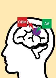 เทโมโซโลไมด์ ยาเคมีบำบัดของผู้ป่วยมะเร็งสมอง ราคาแพง แต่ยืดชีวิตผู้ป่วยได้ดีกว่า