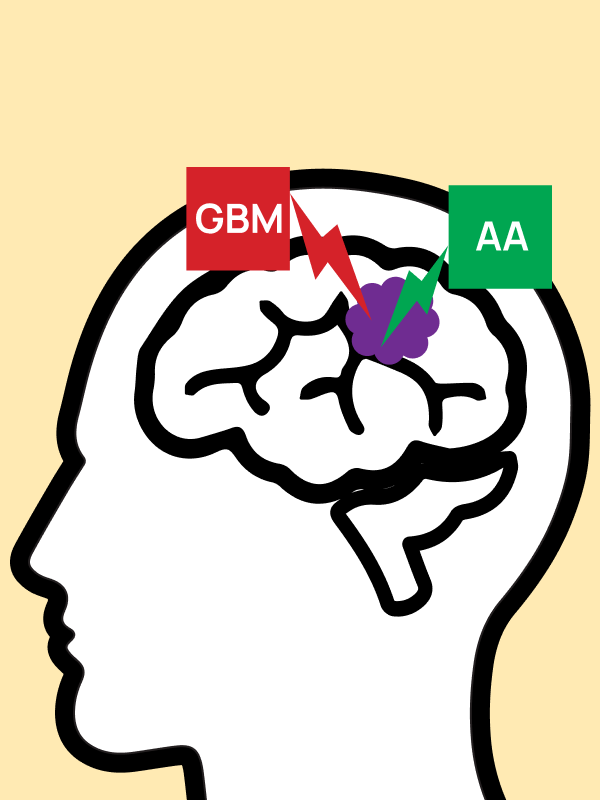 เทโมโซโลไมด์ ยาเคมีบำบัดของผู้ป่วยมะเร็งสมอง ราคาแพง แต่ยืดชีวิตผู้ป่วยได้ดีกว่า