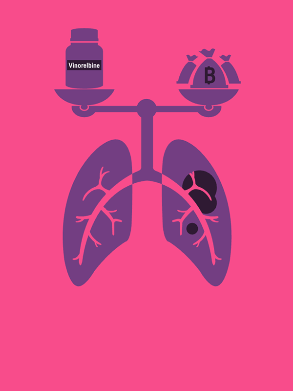รายงานวิจัย: การประเมินความคุ้มค่าทางเศรษฐศาสตร์ของยา Vinorelbine ในการรักษาเสริมมะเร็งปอดชนิดเซลล์ไม่เล็กระยะ II – IIIA ในประเทศไทย