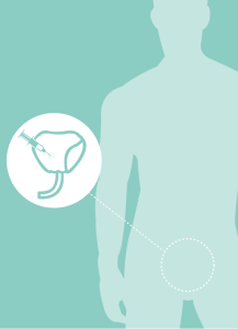 รายงานวิจัย: การประเมินต้นทุนอรรถประโยชน์และผลกระทบทางด้านงบประมาณของ ยากลุ่ม Luteinizing hormone-releasing hormone analogues ในข้อบ่งใช้สาหรับมะเร็งต่อมลูกหมากใน Adjuvant therapy และระยะ Metastatic disease