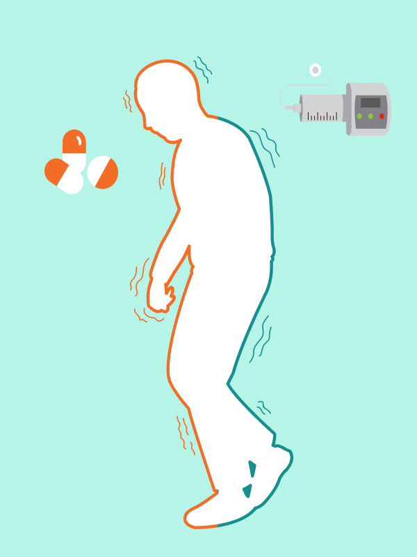 ยาราซาจิลินแและยาอาโปมอร์ฟีนแบบฉีดเข้าชั้นใต้ผิวหนัง ยาใหม่รักษาผู้ป่วยพาร์กินสันระยะรุนแรง ยังไม่ผ่านเกณฑ์ความคุ้มค่า